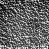 Oberflächen erhalten µm-genaues Profil